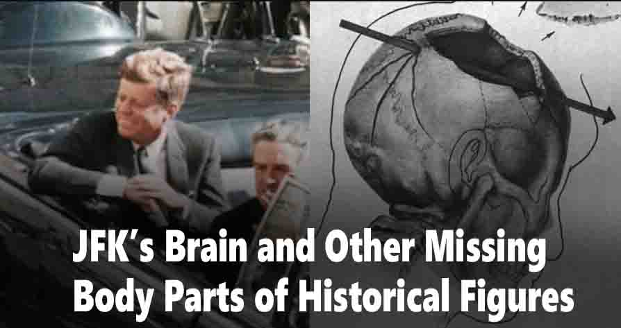 JFK’s Brain and Other Missing Body Parts of Historical Figures